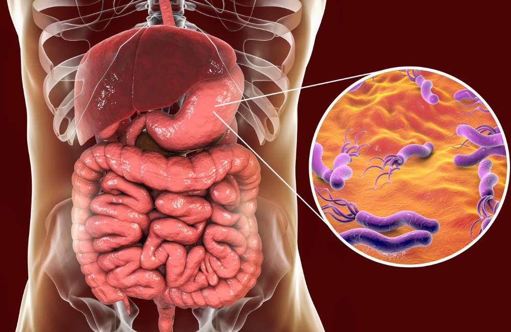 What is H. Pylori